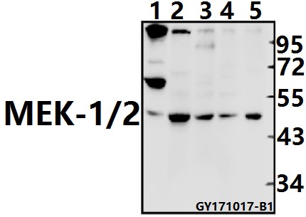 Western blot (WB) analysis of MEK1/2 (S211) pAb at 1:500 dilution
Lane1:CT26 whole cell lysate(40ug)
Lane2:PC12 whole cell lysate(40ug)
Lane3:Panc1 whole cell lysate(40ug)
Lane4:A549 whole cell lysate(40ug)
Lane5:Hela whole cell lysate(20ug)