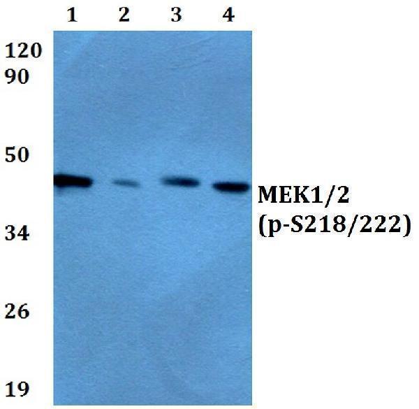 Western blot (WB) analysis of p-MEK1/2 (S218/222) polyclonal antibody at 1:500 dilution
Lane1:A549 cell lysate treated with PMA(100nM,30mins)
Lane2:Raw264