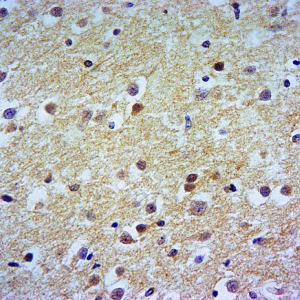 Immunohistochemistry of paraffin-embedded Rat Brain using MEK1(Ser298) antibody at dilution of 1:50