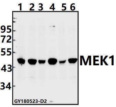 Western blot (WB) analysis of MEK1 (Ser298) pAb at 1:500 dilution
Lane1:A549 whole cell lysate(40ug)
Lane2:SGC7901 whole cell lysate(40ug)
Lane3:H1792 whole cell lysate(40ug)
Lane4:U-87MG whole cell lysate(40ug)
Lane5:C6 whole cell lysate(40ug)
Lane6:CT26 whole cell lysate(40ug)