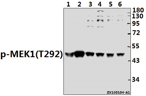 Western blot (WB) analysis of p-MEK1 (T292) pAb at 1:500 dilution
Lane1:CT26 whole cell lysate(40ug)
Lane2:H9C2 whole cell lysate(40ug)
Lane3:A2780 whole cell lysate(40ug)
Lane4:H1792 whole cell lysate(40ug)
Lane5:SGC7901 whole cell lysate(40ug)
Lane6:A549 whole cell lysate(40ug)
