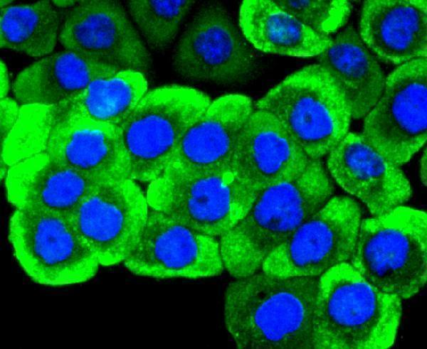 ICC staining Ret in AGS cells (green)