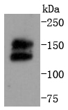 Western blot analysis of Ret on MCF-7 cells lysates using anti-Ret antibody at 1/1,000 dilution