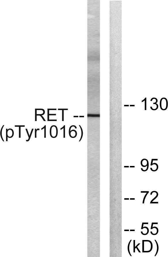 Western blot analysis of lysates from COS7 cells treated with EGF 200ng/ml 30', using Ret (Phospho-Tyr1015) Antibody