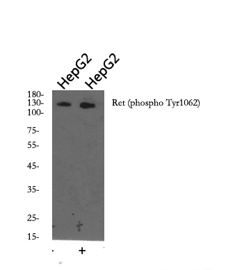 Western blot analysis of Ret (phospho Tyr1062) Polyclonal Antibody, using HepG2 cell treated or untreated with forskolin 40nM 30', 4° over night, secondary antibody was diluted at 1:10000, 37° 1hour