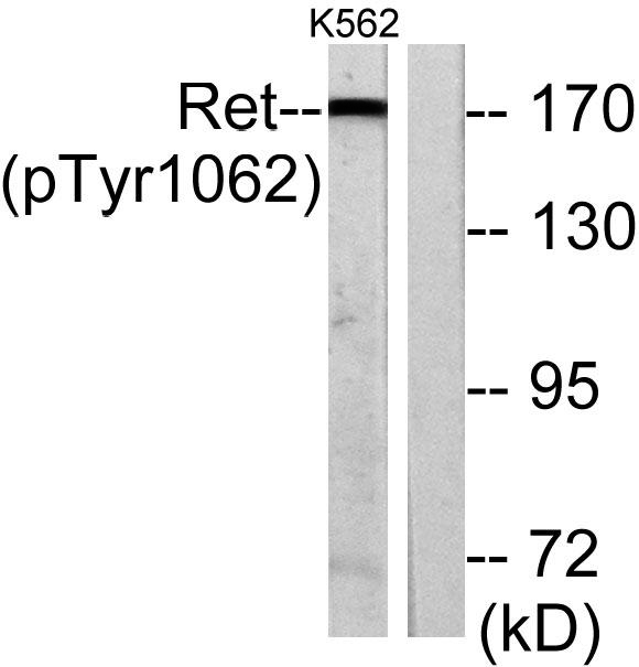 Western blot analysis of lysates from K562 cells, using Ret (Phospho-Tyr1062) Antibody