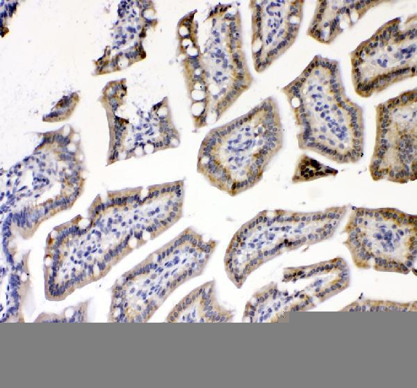  IHC analysis of TNFRSF1A using anti-TNFRSF1A antibody (A00294-3)