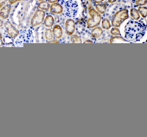a00294 3 tnfrsf1a primary antibodies ihc testing 4
