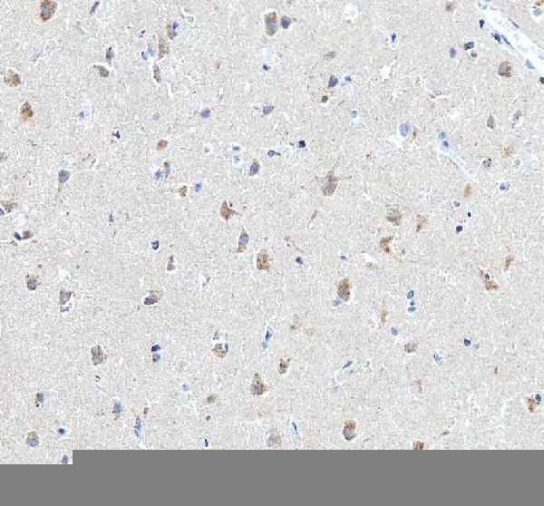 a00294 3 tnfrsf1a primary antibodies ihc testing 5