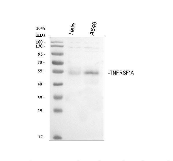  Western blot analysis of TNFRSF1A using anti-TNFRSF1A antibody (A00294-3)