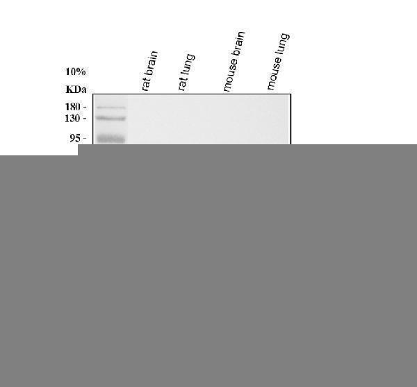  Western blot analysis of TNFRSF1A using anti-TNFRSF1A antibody (A00294-3)