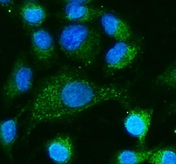 IF analysis of TNFRSF1A using anti-TNFRSF1A antibody (A00294)