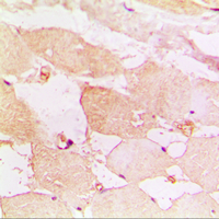 a00295 1 cxcr3 primary antiboties ihc testing 2