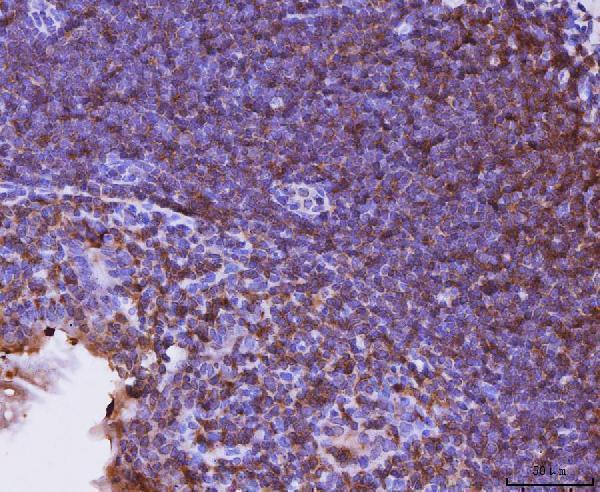  IHC analysis of Cxcr3 using anti-Cxcr3 antibody (A00295-2)