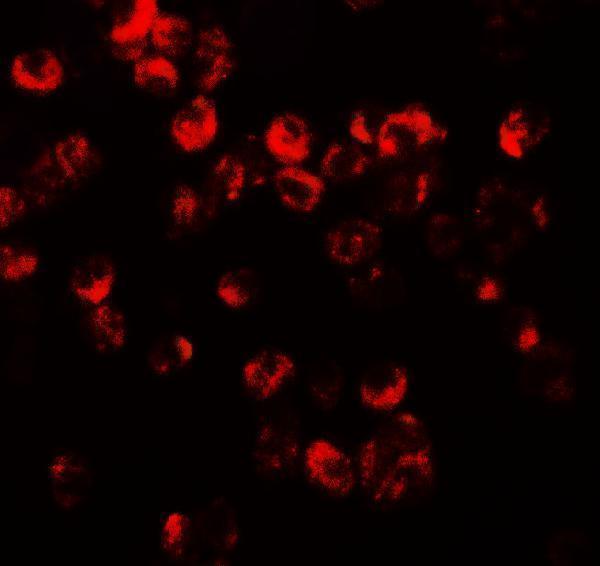 Immunofluorescence of CXCR3 in HepG2 cells with CXCR3 antibody at 20 μg/mL