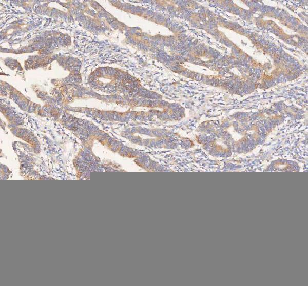  IHC analysis of ERBB4 using anti-ERBB4 antibody (A00296-1)