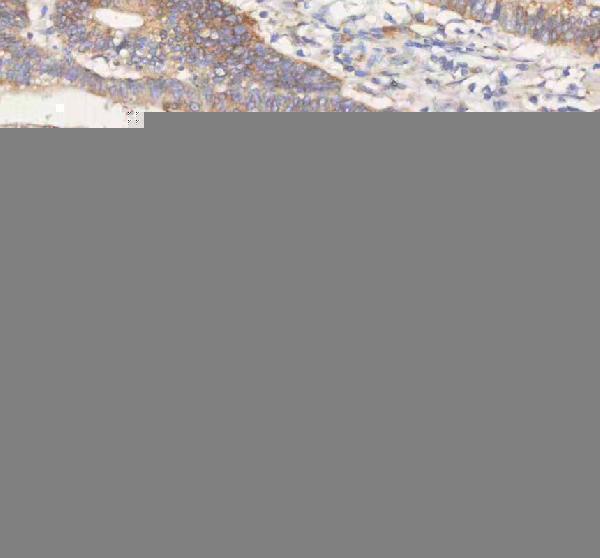  IHC analysis of ERBB4 using anti-ERBB4 antibody (A00296-1)