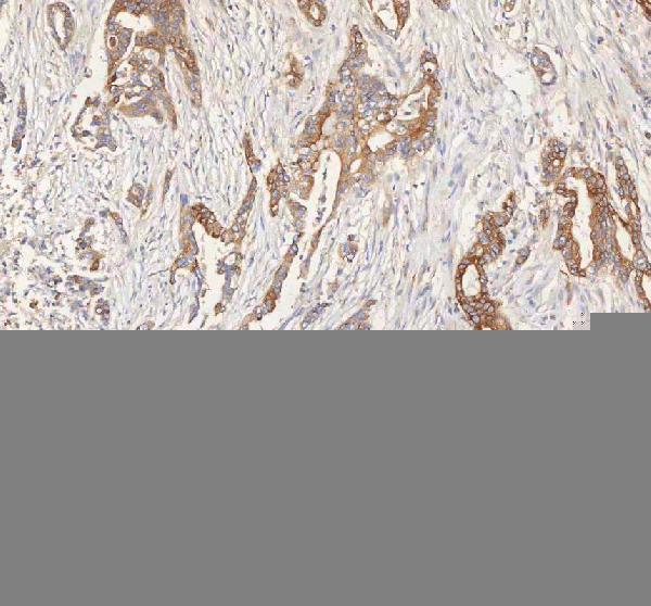 a00296 1 erbb4 primary antibodies ihc testing 4