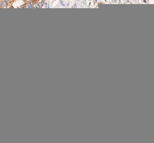 a00296 1 erbb4 primary antibodies ihc testing 5