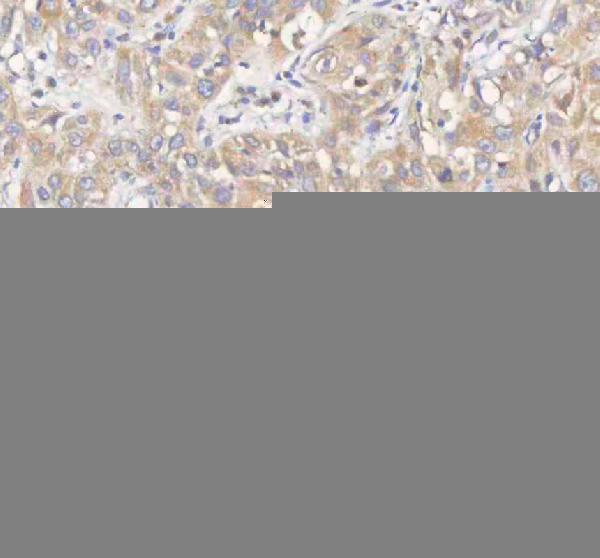 a00296 1 erbb4 primary antibodies ihc testing 9
