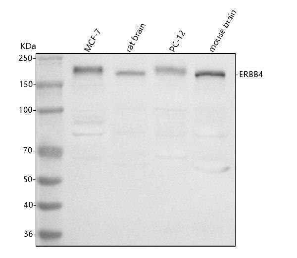  Western blot analysis of ERBB4 using anti-ERBB4 antibody (A00296-1)