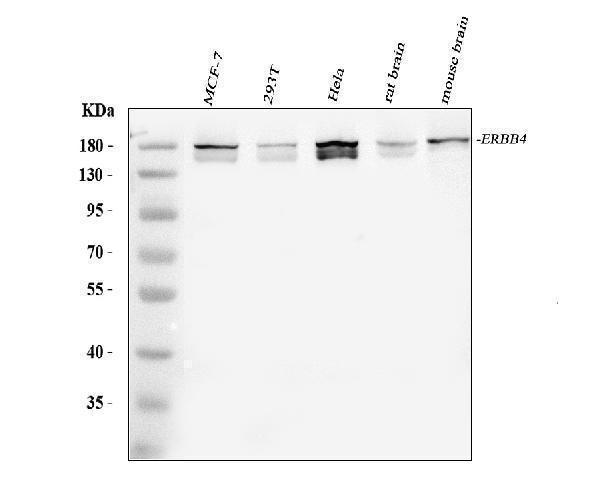 Western blot analysis of ERBB4 using anti-ERBB4 antibody (A00296)