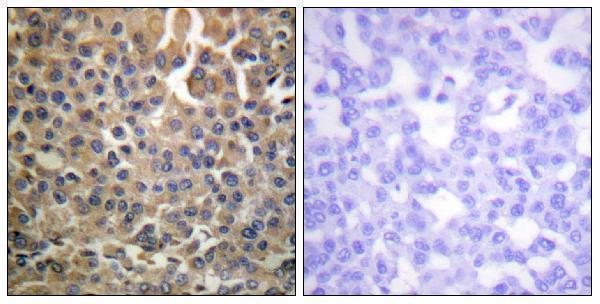 a00296y1284 1 erbb4 primary antibodies ihc testing 3
