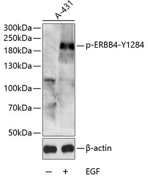 a00296y1284 erbb4 primary antiboties wb testing 1
