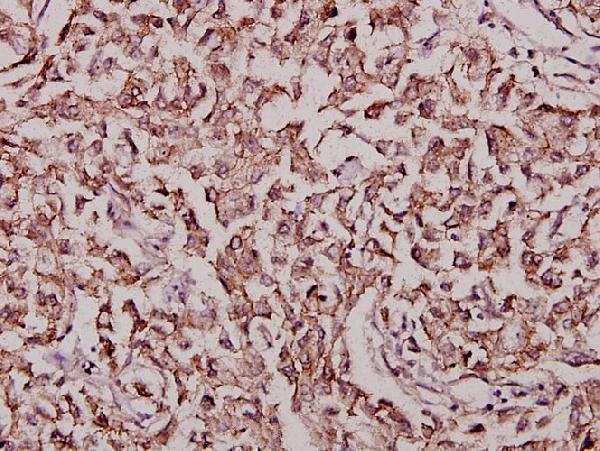 a00297s368 fos primary antiboties ihc testing 2