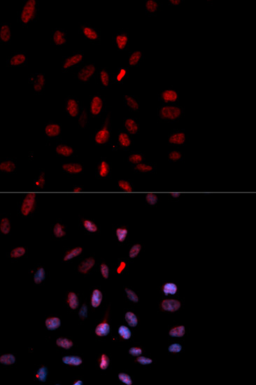 a00297t232 fos primary antiboties if testing 1