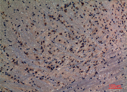 Immunohistochemical analysis of paraffin-embedded mouse-brain, antibody was diluted at 1:100