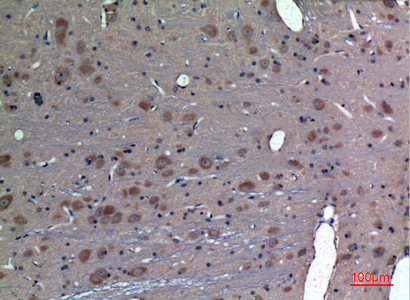 Immunohistochemical analysis of paraffin-embedded rat-brain, antibody was diluted at 1:100