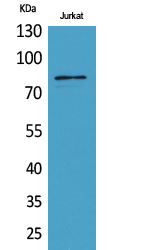 Western Blot analysis of Jurkat cells using PREP Polyclonal Antibody