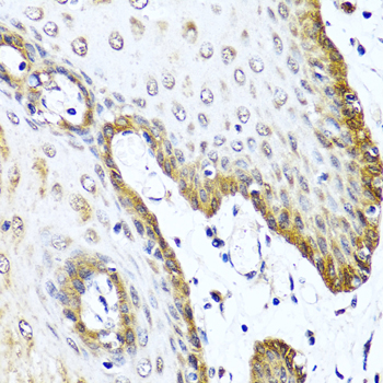 a00299 vip primary antiboties ihc testing 2