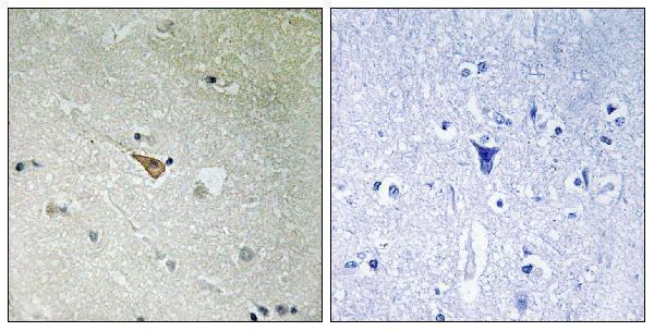 a00301y1096 1 alk primary antibodies ihc testing 2