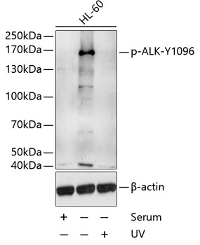 a00301y1096 alk primary antiboties wb testing 1