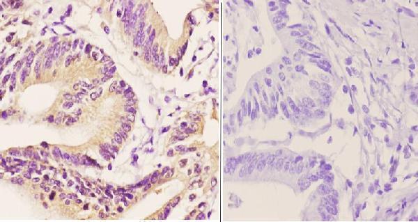 a00302 1 tbp primary antiboties ihc testing 2