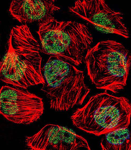 a00302 2 anti tbp antibody center if testing 1