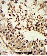 a00302 2 anti tbp antibody center ihc p testing 3