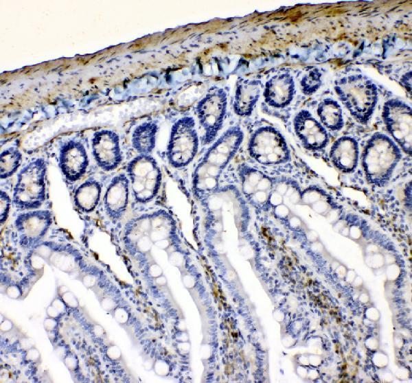  IHC analysis of VASP using anti-VASP antibody (A00303-1)
