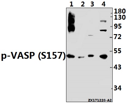 Western blot (WB) analysis of p-VASP (S157) pAb at 1:1000 dilution
Lane1:Jurkat whole cell lysate(40ug)
Lane2:K562 whole cell lysate(40ug)
Lane3:The Lung tissue lysate of Rat(40ug)
Lane4:3T3-L1 whole cell lysate(40ug)