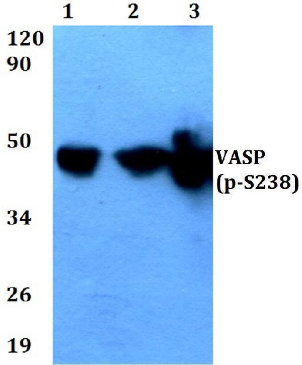 Western blot (WB) analysis of p-VASP (S238) polyclonal antibody at 1:500 dilution
Lane1:Hela cell lysate treated with forskolin (10nM, 72h)
Lane2:Raw264