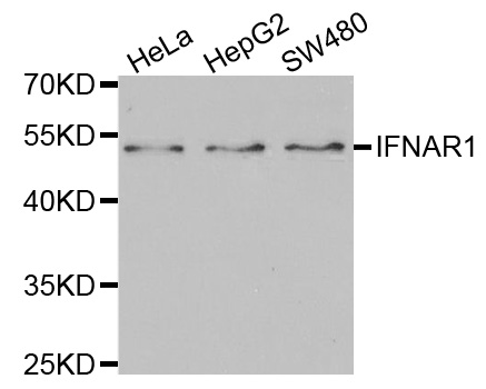 Western blot analysis of IFN-R1 polyclonal antibody