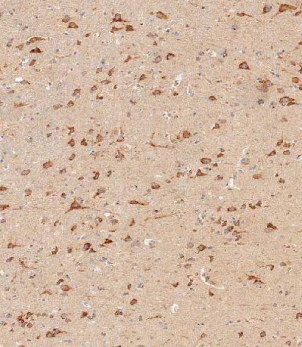Immunohistochemical analysis of paraffin-embedded human brain tissue using A00306 performed on the Leica® BOND RXm