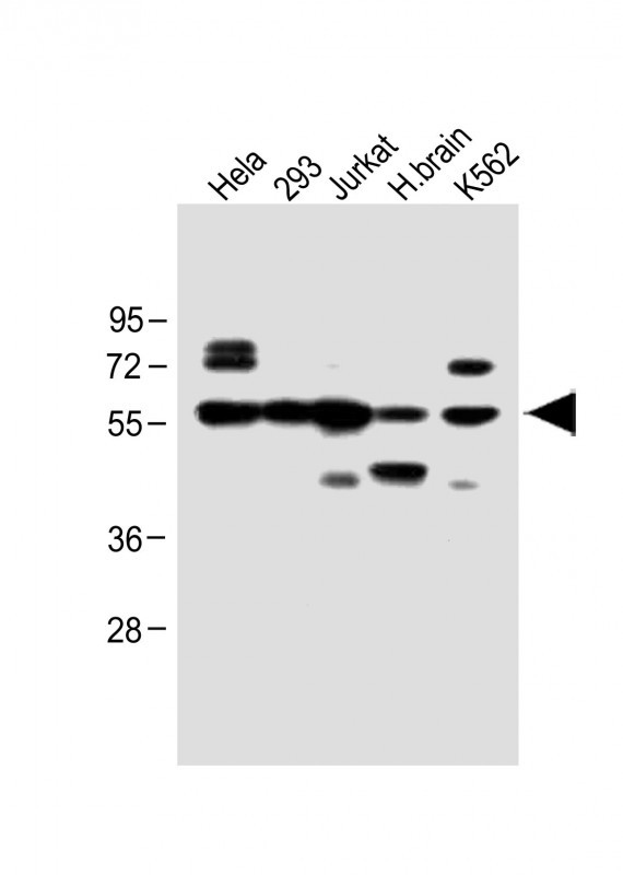 All lanes : Anti-IFNAR1 Antibody (Center) at 1:1000 dilutionLane 1: Hela whole cell lysateLane 2: 293 whole cell lysateLane 3: Jurkat whole cell lysateLane 4: H