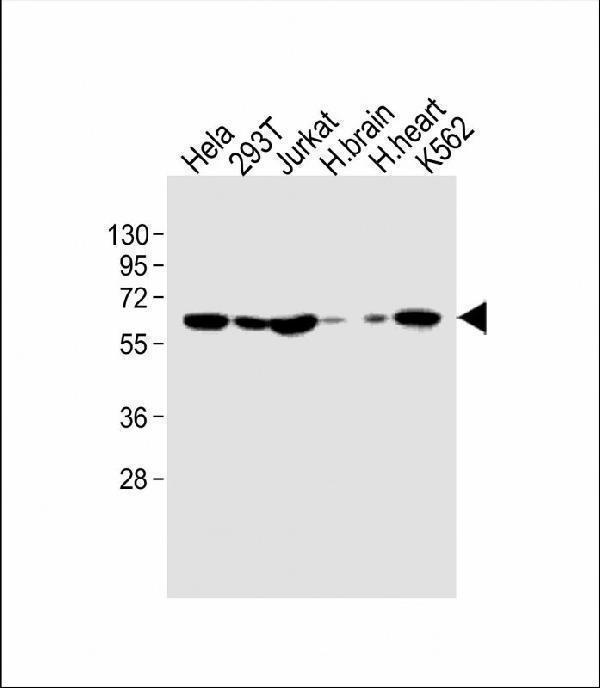 All lanes : Anti-IFNAR1 Antibody (Center) at 1:1000 dilutionLane 1: Hela whole cell lysateLane 2: 293T whole cell lysateLane 3: Jurkat whole cell lysateLane 4: human brain lysateLane 5: human heart lysateLane 6: K562 whole cell lysateLysates/proteins at 20 µg per lane