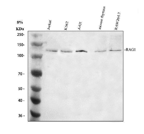 Western blot analysis of RAG1 using anti-RAG1 antibody (A00307-1)