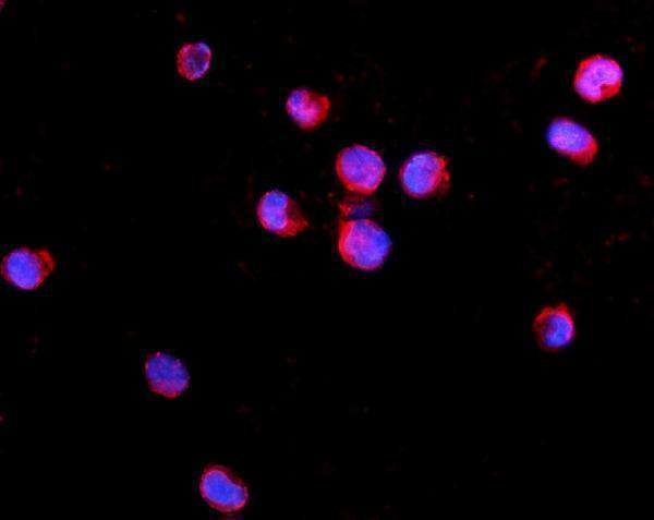  IF analysis of IL2 Receptor gamma/IL2RG using anti-IL2 Receptor gamma/IL2RG antibody (A00308-1)