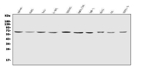  Western blot analysis of IL2 Receptor gamma/IL2RG using anti-IL2 Receptor gamma/IL2RG antibody (A00308-1)