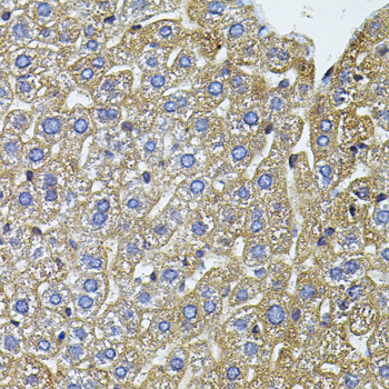 Immunohistochemistry of paraffin-embedded mouse liver using CETP antibody  